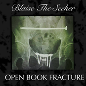 Open Book Fracture