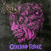 Cérebro Podre