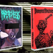 Pancreatic Purulence / Hyperemesis