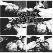 Brain Removal