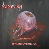 Suppression: Repugnant Remains