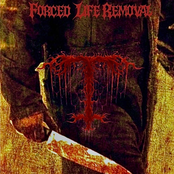 FORCED LIFE REMOVAL
