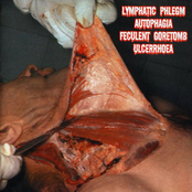Lymphatic Phlegm / Autophagia / Feculent Goretomb / Ulcerrhoea - 4 Way Split CD