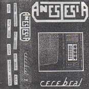 Anestesia Cerebral