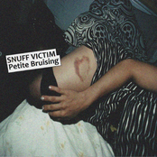 Petite Bruising