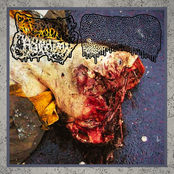 Split With Lymphoedema