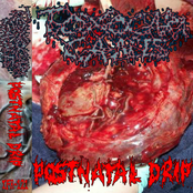 Postnatal Drip