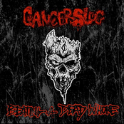 Cancerslug: Beating a Dead Whore