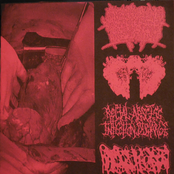 Agonizing Excess Bowel Acid Dissolving the Intestines Causing Massive Organ Trauma / Carcinomas of Unknown Primary Origin / Rectal Abscess Infection Discharge / Hydrocephalus