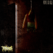 Torn Open: None So Vile