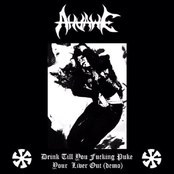 Drink ‘Till You Fucking Puke Your Liver Out