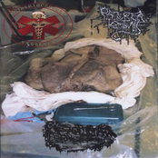 Streptococcus Pyogenes / Pancreatectomie / Pseudomonas Aeruginosa