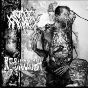 Split W/ Resin Cough