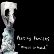 Feeding Fingers: Wound In Wall