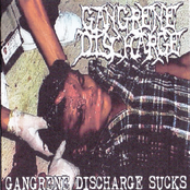 Gangrene Discharge Sucks