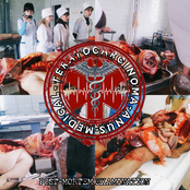 POST-MORTEM EXAMINATION