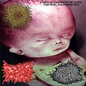3 Ways of Diagnostic Methods for Fetal Malformations