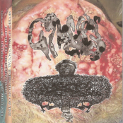 Severe Gonococcal Infection Of The Pus Filled Urinary Tract