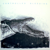 Head Sand by Controlled Bleeding