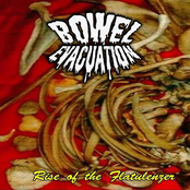 Rise Of The Flatulenzer