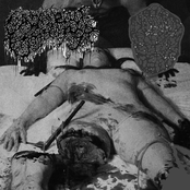 Gangrenous Erythromelalgia / xIxCxSxPx  Split Tape