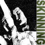Skinning