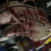 I Think I'm Still Bleeding