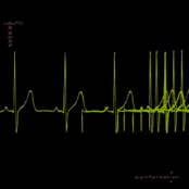 Modulator/demodulator by Usurp Synapse