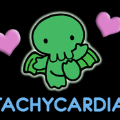 tachycardia