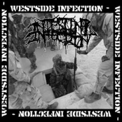 Westside infection