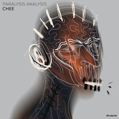 Paralysis Analysis EP
