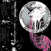 DEMO // SUBCUTANEOUS