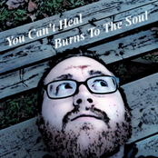 You Can't Heal...Burns To The Soul
