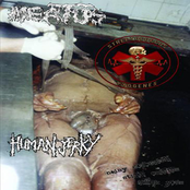 Noisy Goregrind Still Exists! Fuck You!