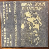 Human Brain Replacement