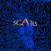 Scars