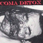 coma detox