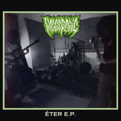 Eter EP