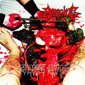 Ingestion Of Colotomic Funk by Impaled