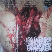 A Messy Liquefied Build-Up Of Partially Melted Internal Organs Brought Upon By Unknown Viral, Bacteriological, or Toxicological Means Ultimately Leading To Eventual Total Dissolution Of The Nearby Neighboring Structurized Tissue Formations