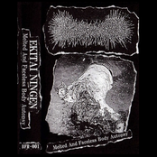 Melted And Faceless Body Autopsy