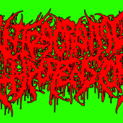 intracranial hypotension