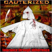 Suicide Gene by Cauterized