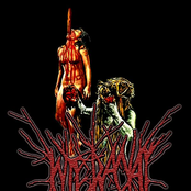 Acquired Immune Deficiency Syndrome