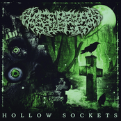 HOLLOW SOCKETS - Single
