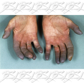 big smile lee vol. 2