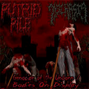 Genocide Of The Unborn / Bodies On Display