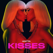 Kisses