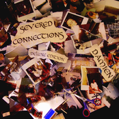 Severed Connections Deluxe Edition