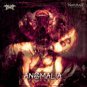 Anomalia